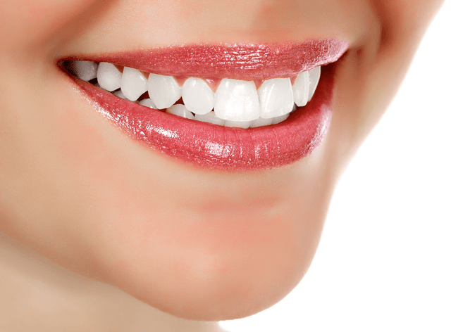 Zahnfüllungen - Unsichtbare Zahnfüllungen für attraktives Aussehen