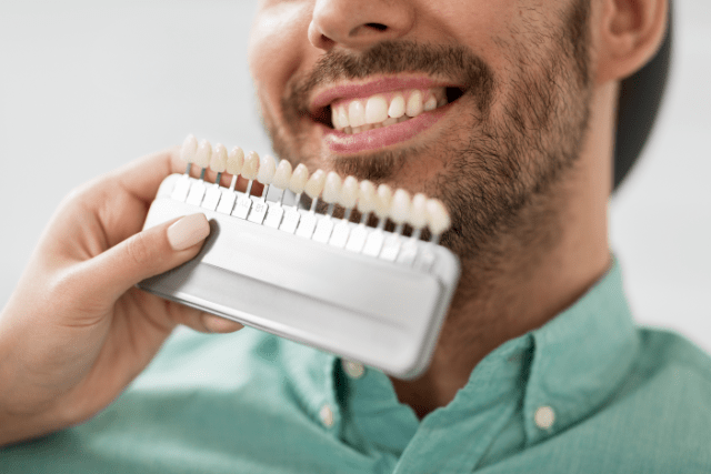 Wie viel kosten Veneers? Der Preis für ein schönes Lächeln hängt u.a. vom Verfahren ab.