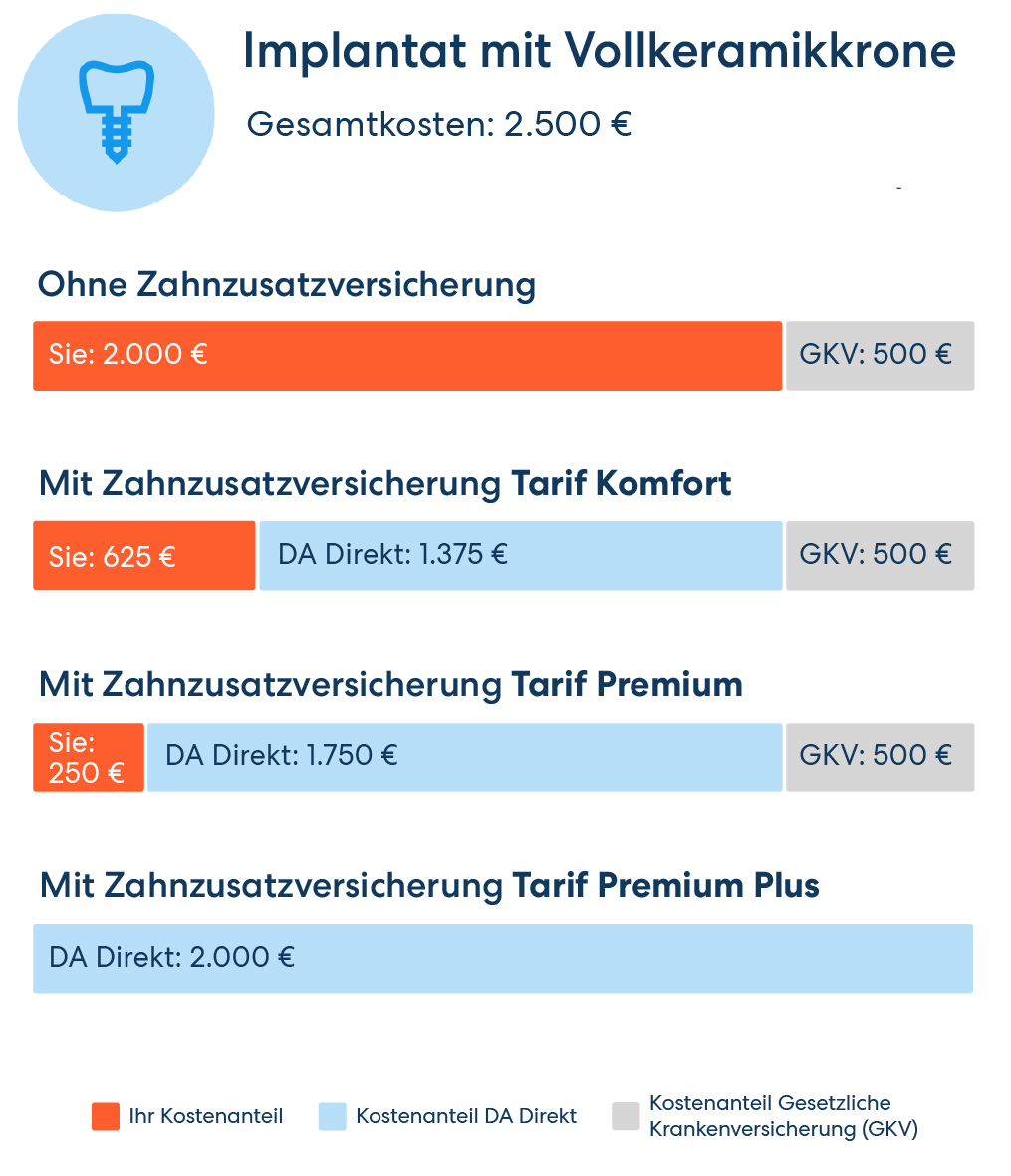 Unsere Zahnzusatzversicherung erstattet Ihnen auch die Kosten für hochwertigen Zahnersatz – im Tarif Premium Plus sogar 100 % des Rechnungsbetrags.